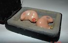 0322840-0322841 Ahs Vintage Pair Hearing Aids For Parts Or Repair