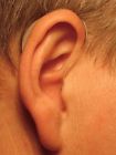 Pulse Ps 60 Gn Resound New Pair Left Right Digital Hearing