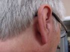 T.21 Austar Tiny Hearing Enhancer